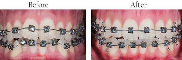 North Miami Beach dental images