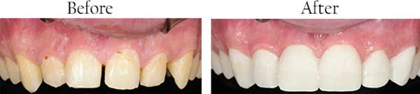 North Miami dental images